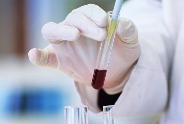 Haematology ALETHIA ADVANCED DIAGNOSTICS